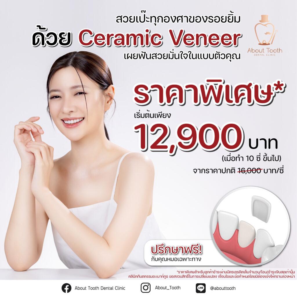 โปรโมชั่น เซรามิก วีเนียร์