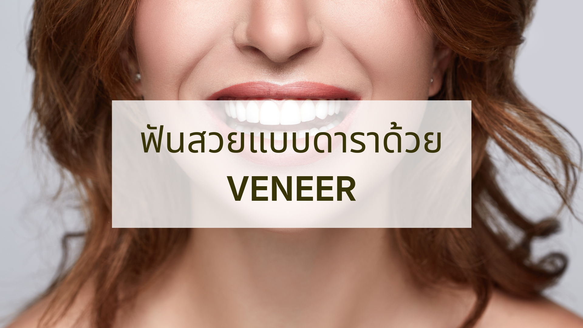 Smile Makeover Veneer