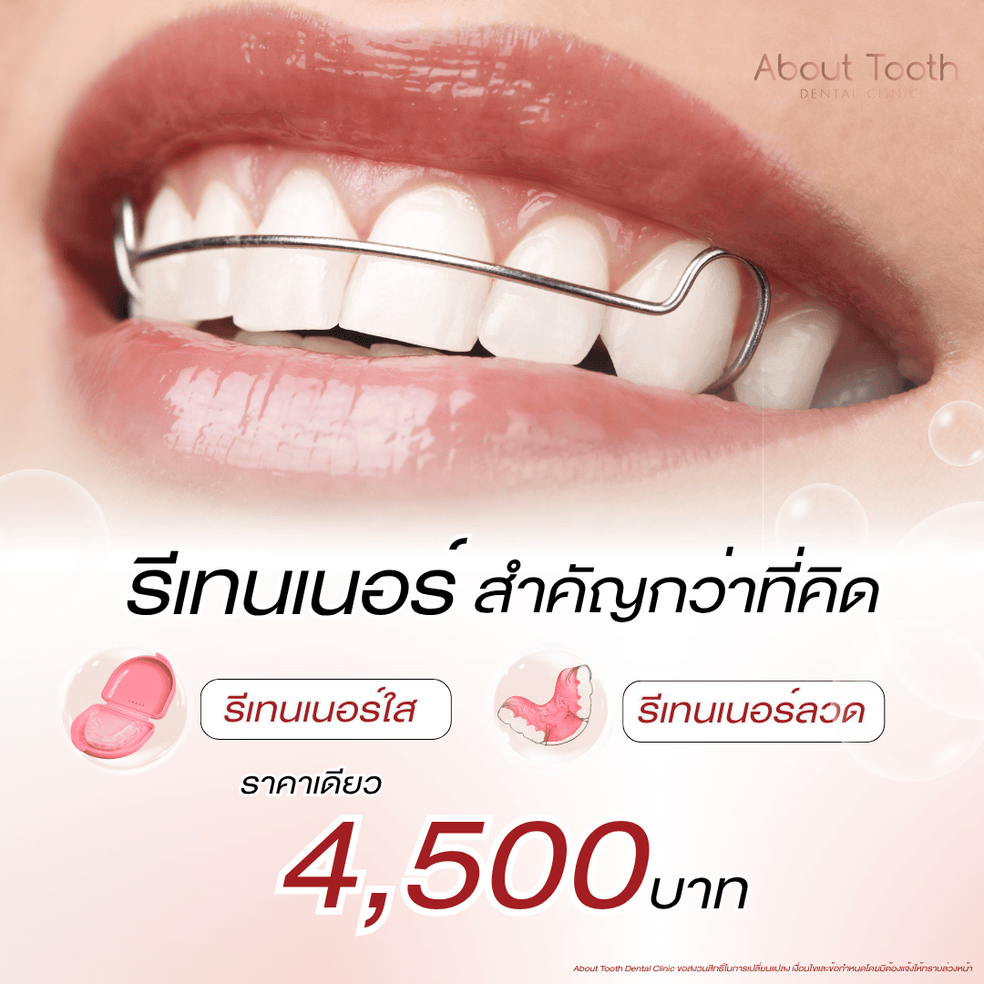 รีเทนเนอร์