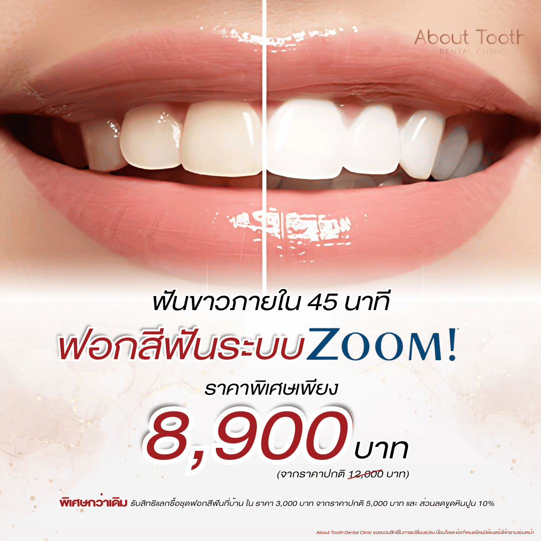 ฟอกสีฟัน