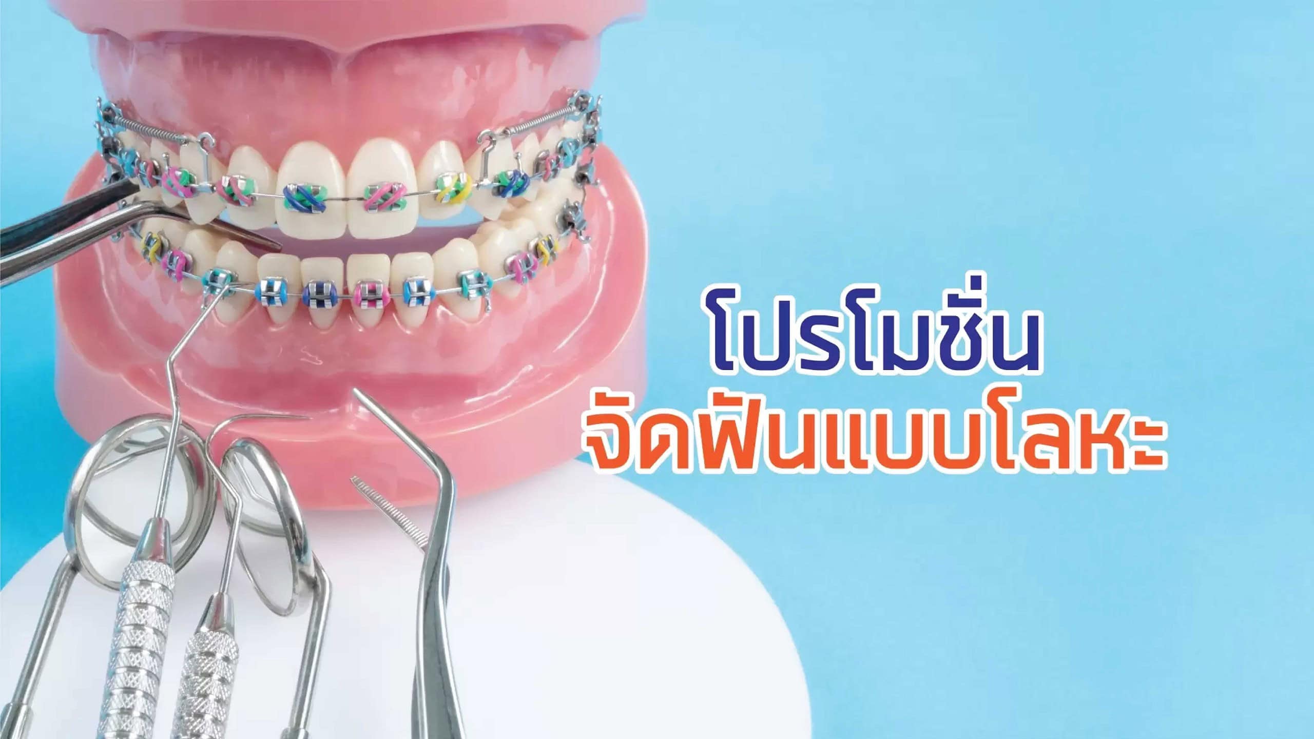 จัดฟันแบบโลหะ (แบบเหล็ก)