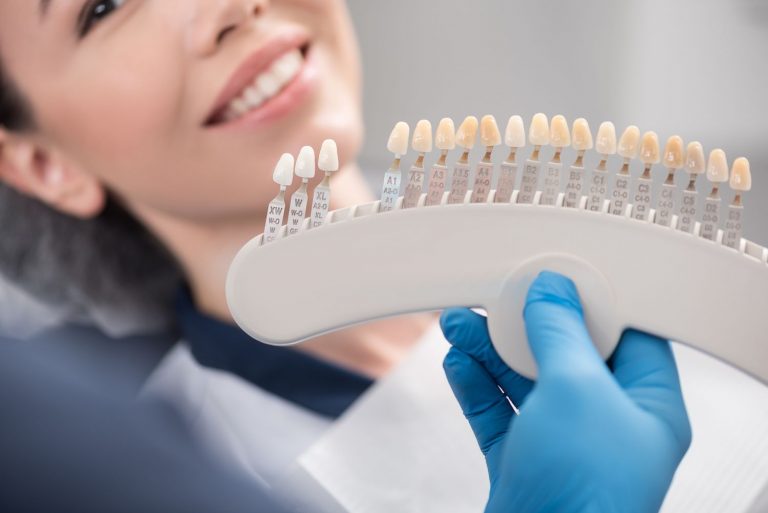ทำวีเนียร์ คลินิกทำฟัน - About Tooth Dental