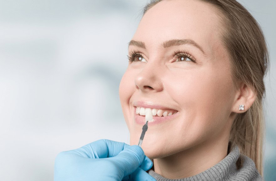 Read more about the article The Cost of Veneers: Understanding the Investment and Long-Term Benefits