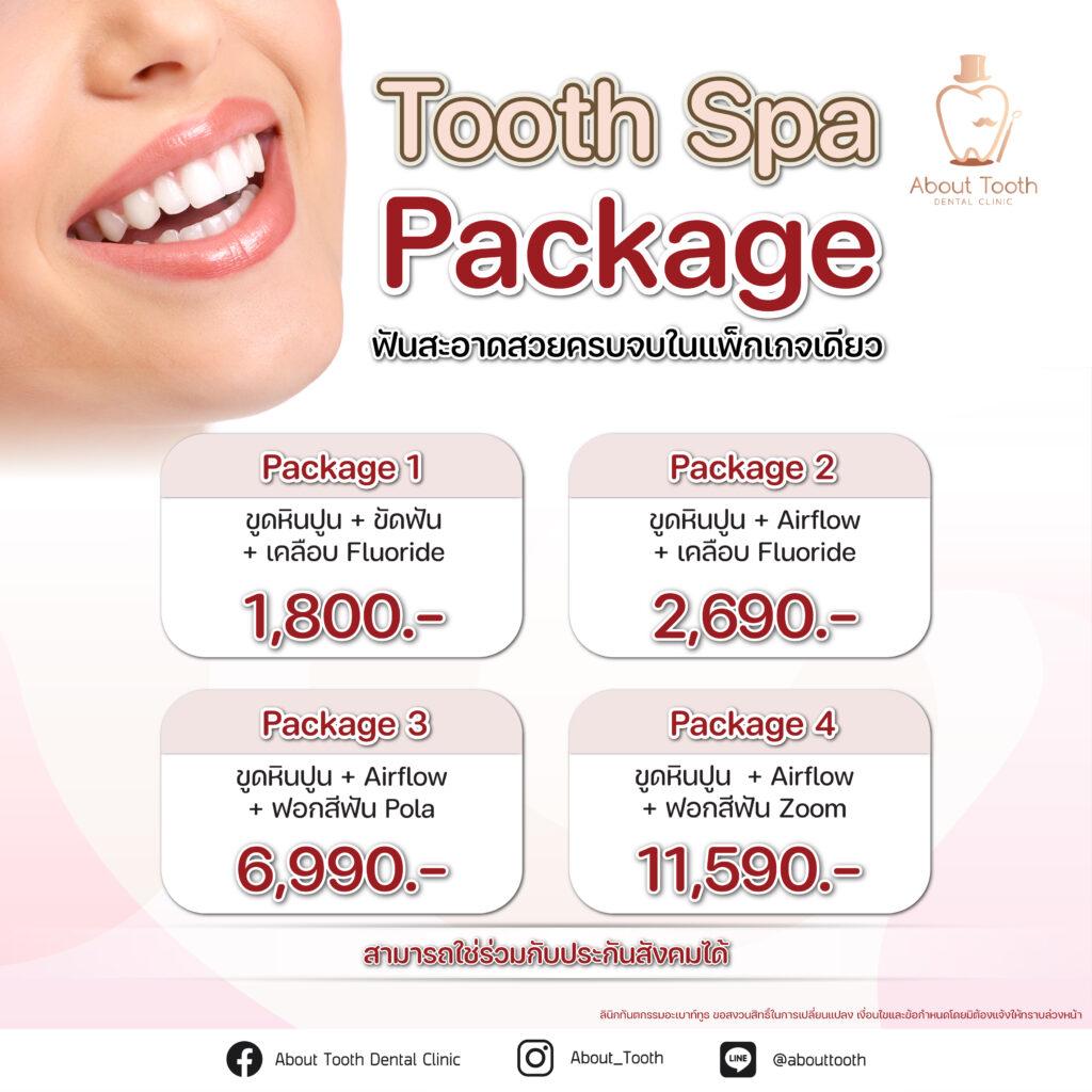 Tooth Spa Package promotion