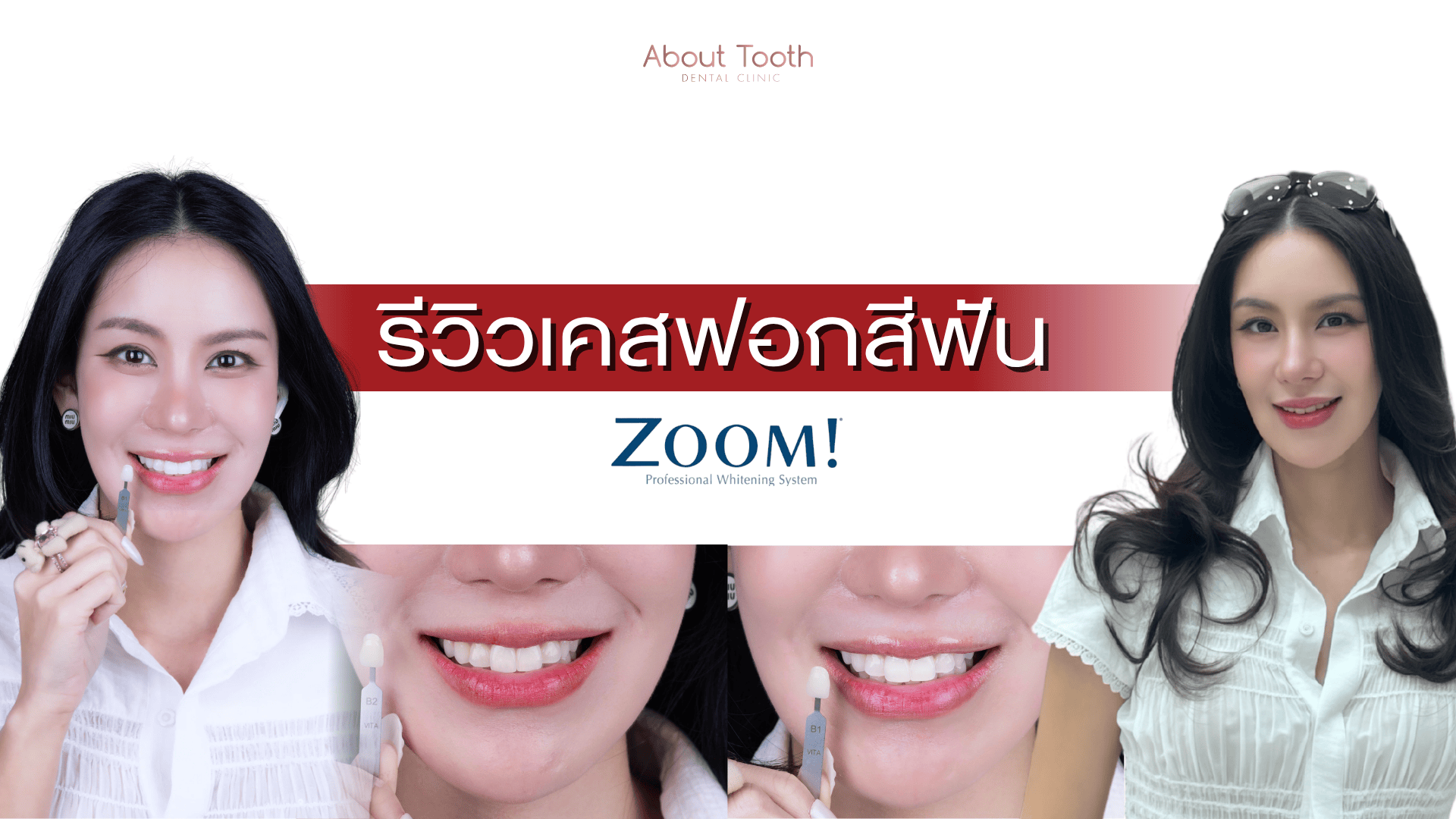 ฟอกสีฟัน