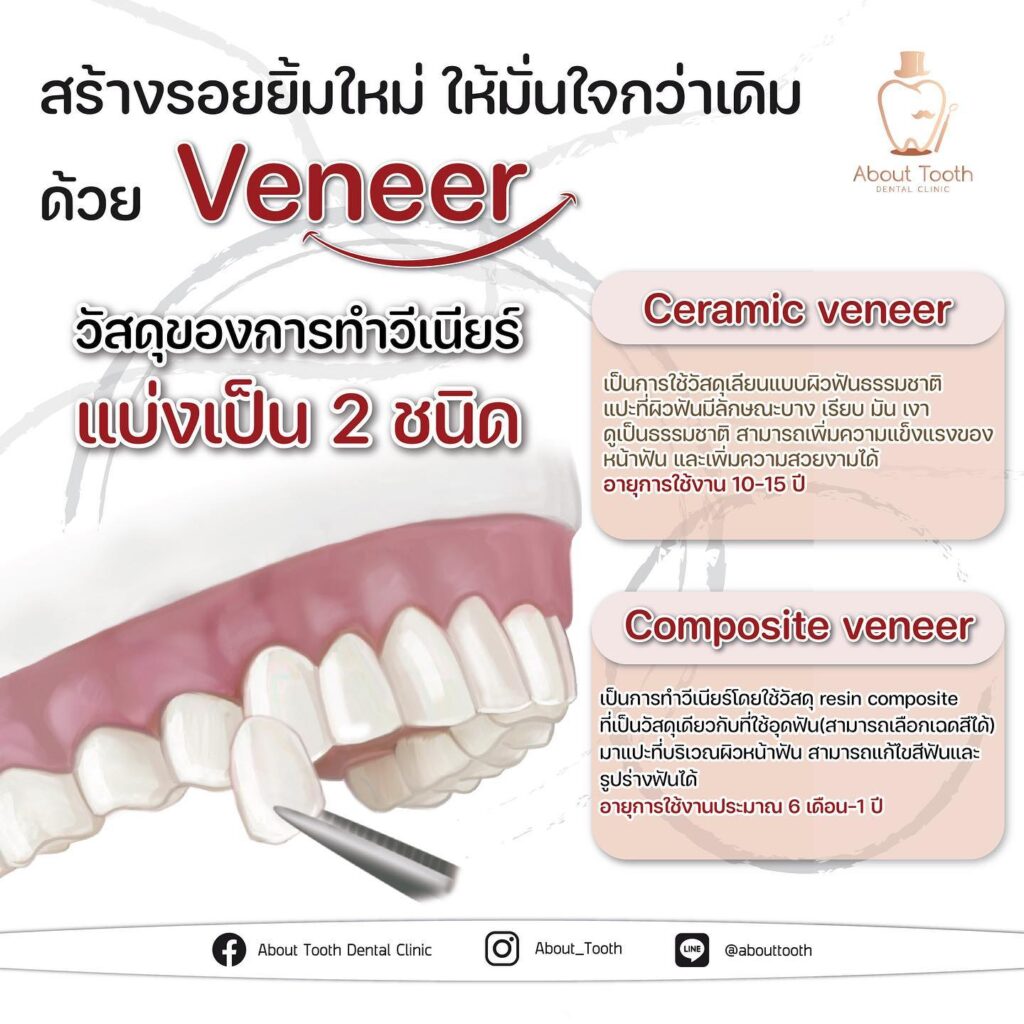 รู้จักว่าการทำวีเนียร์มีกี่แบบ