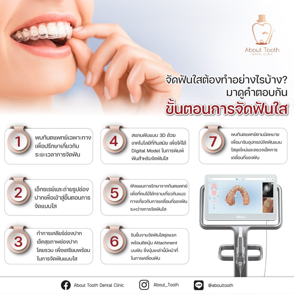 แนะนำขั้นตอนในการจัดฟันแบบใส