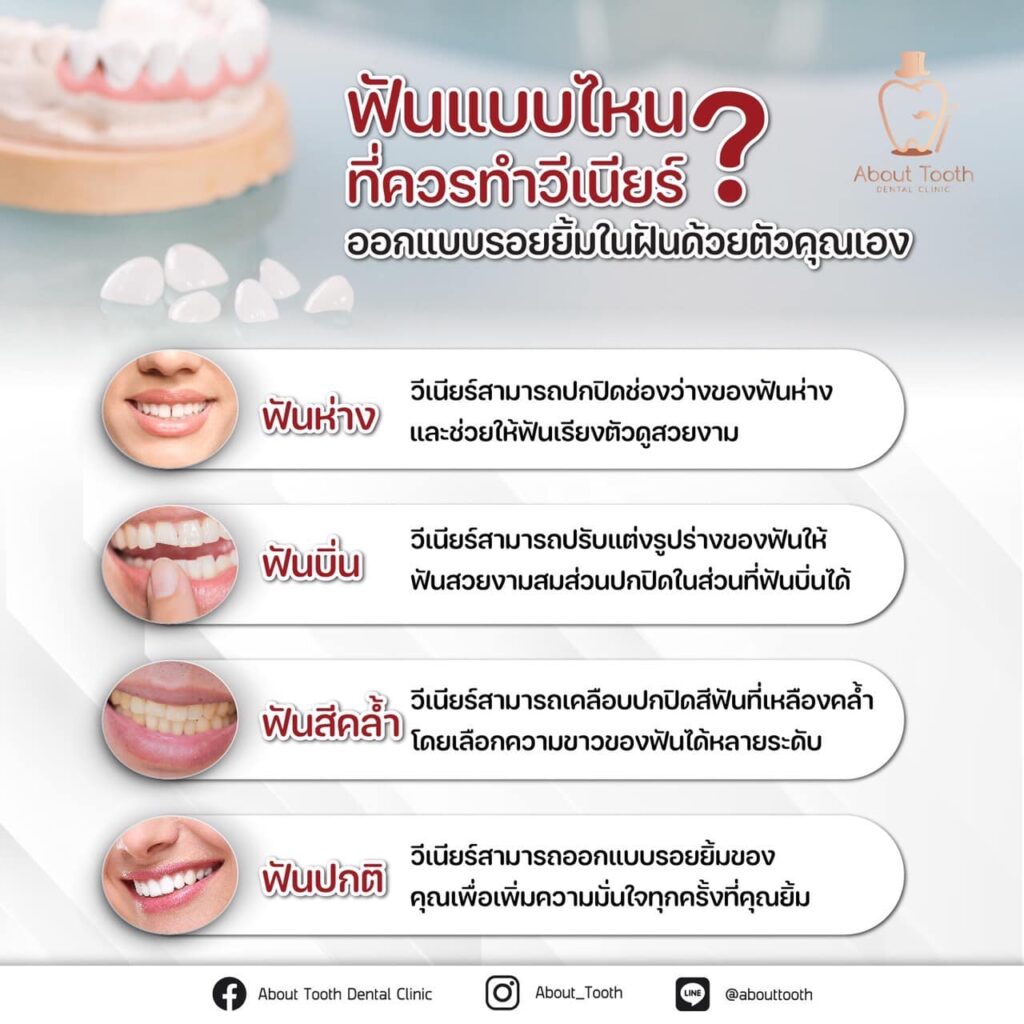 ปัญหาฟันที่ควรทำวีเนียร์