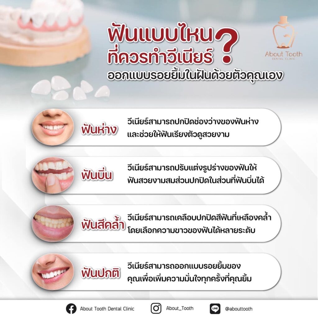 ฟันแบบไหนควรทำวีเนียร์