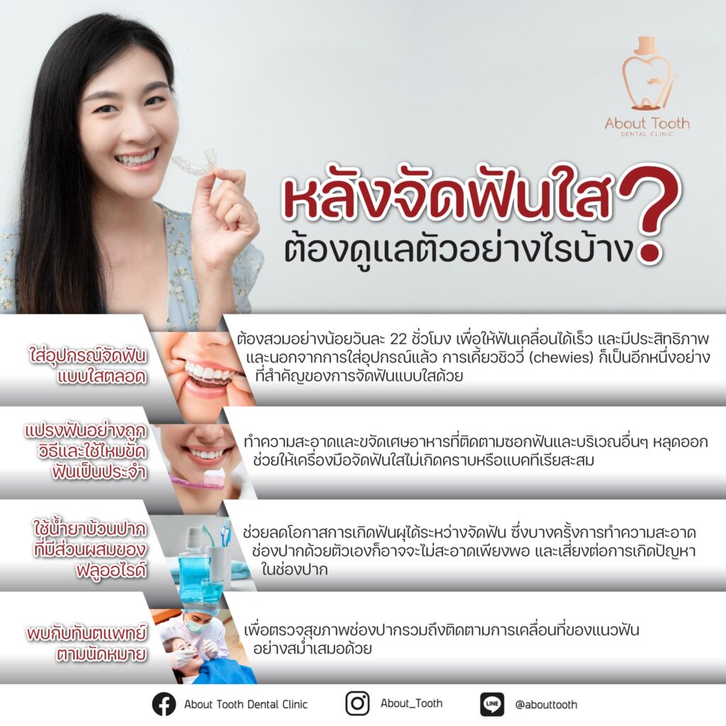 วิธีดูแลหลังจากการจัดฟันแบบใส