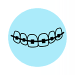 Damon Braces