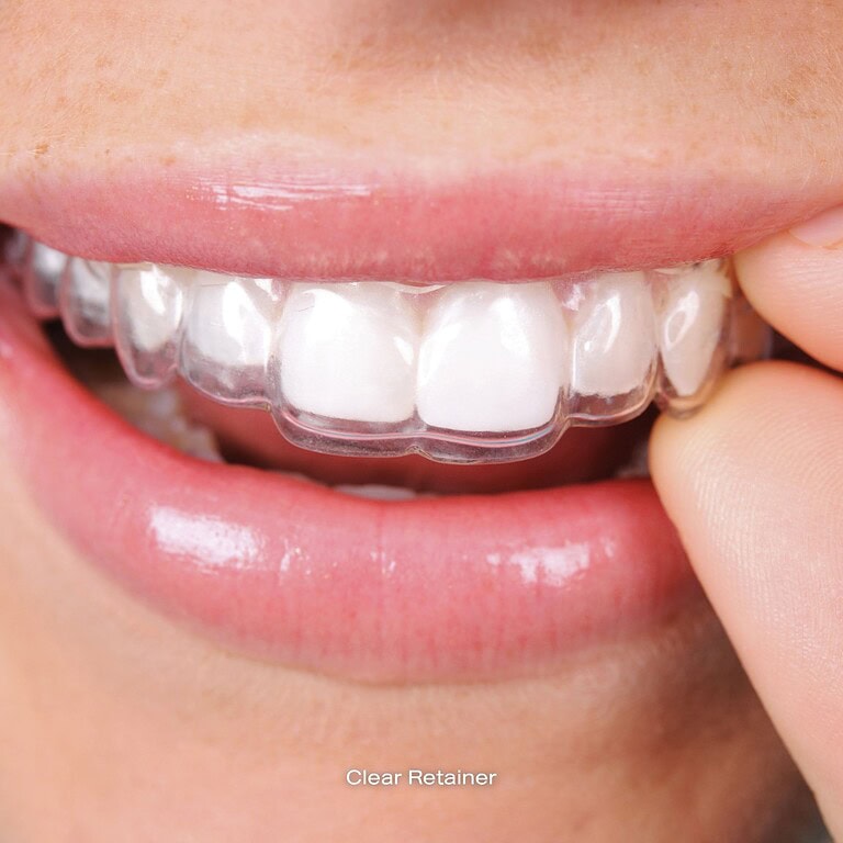 Wire Retainer