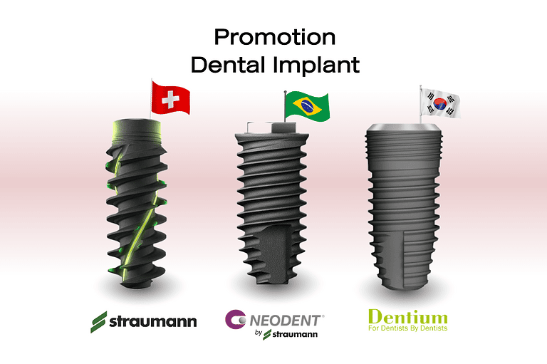 Dental-Implant -Promotion