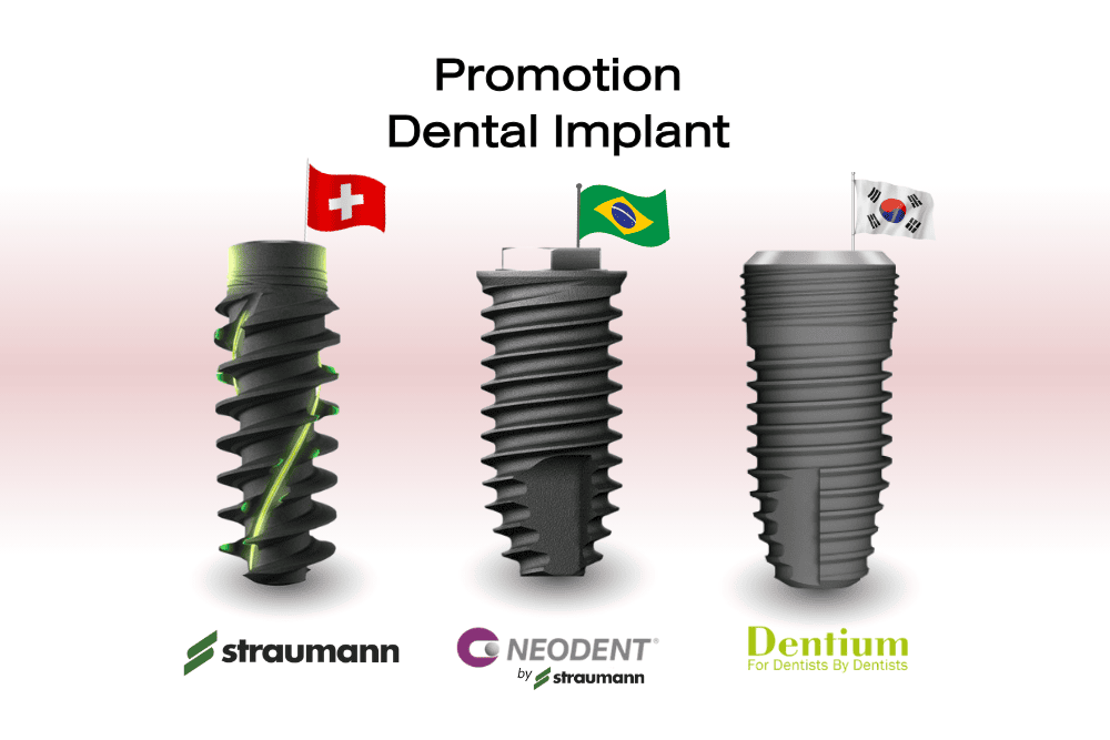 Dental-Implant -Promotion