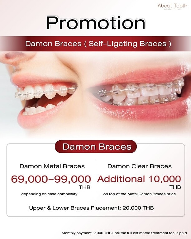 damon-price