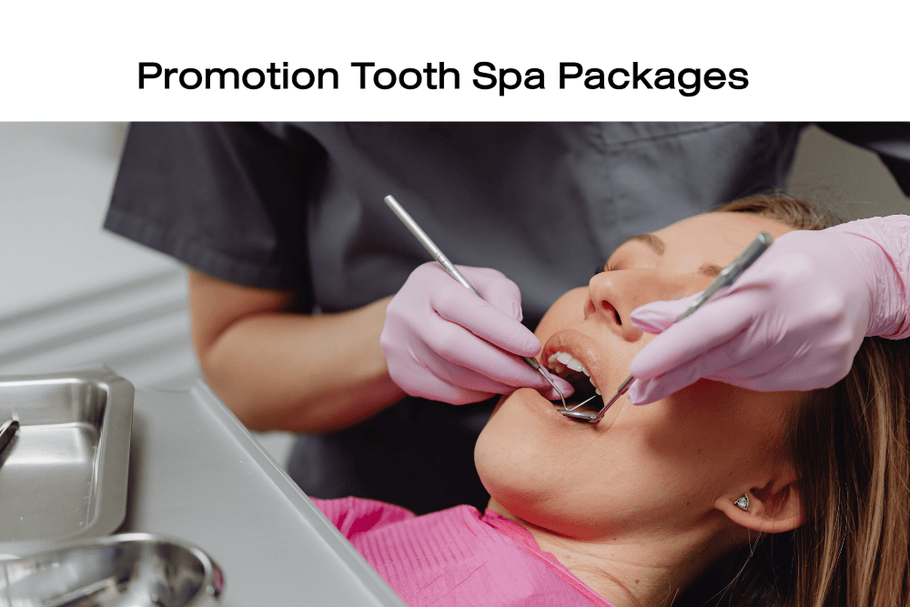 Read more about the article Tooth Spa Packages
