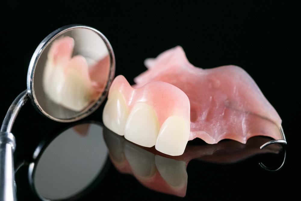 A partial denture ready to be worn