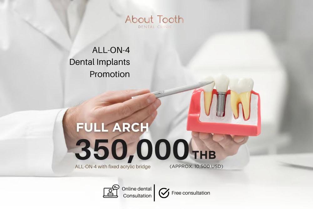 All-on-4 dental implants promotion offer at 350,000 THB at About Tooth Dental clinic in Thailand