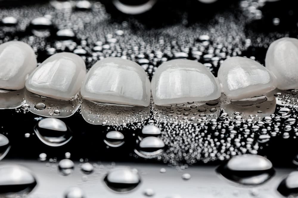 Close-up veneer material for how to take care of veneers