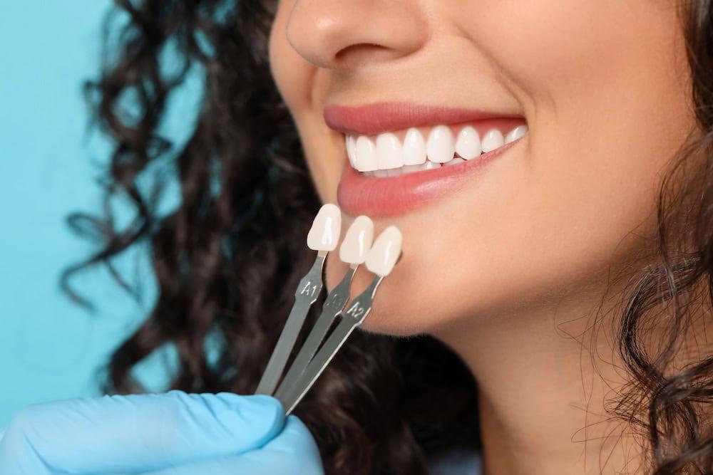Dentist guides how to maintain veneers during smile assessment