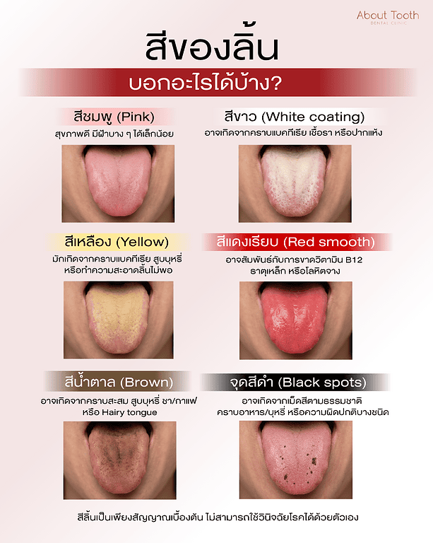 tongue-color-1