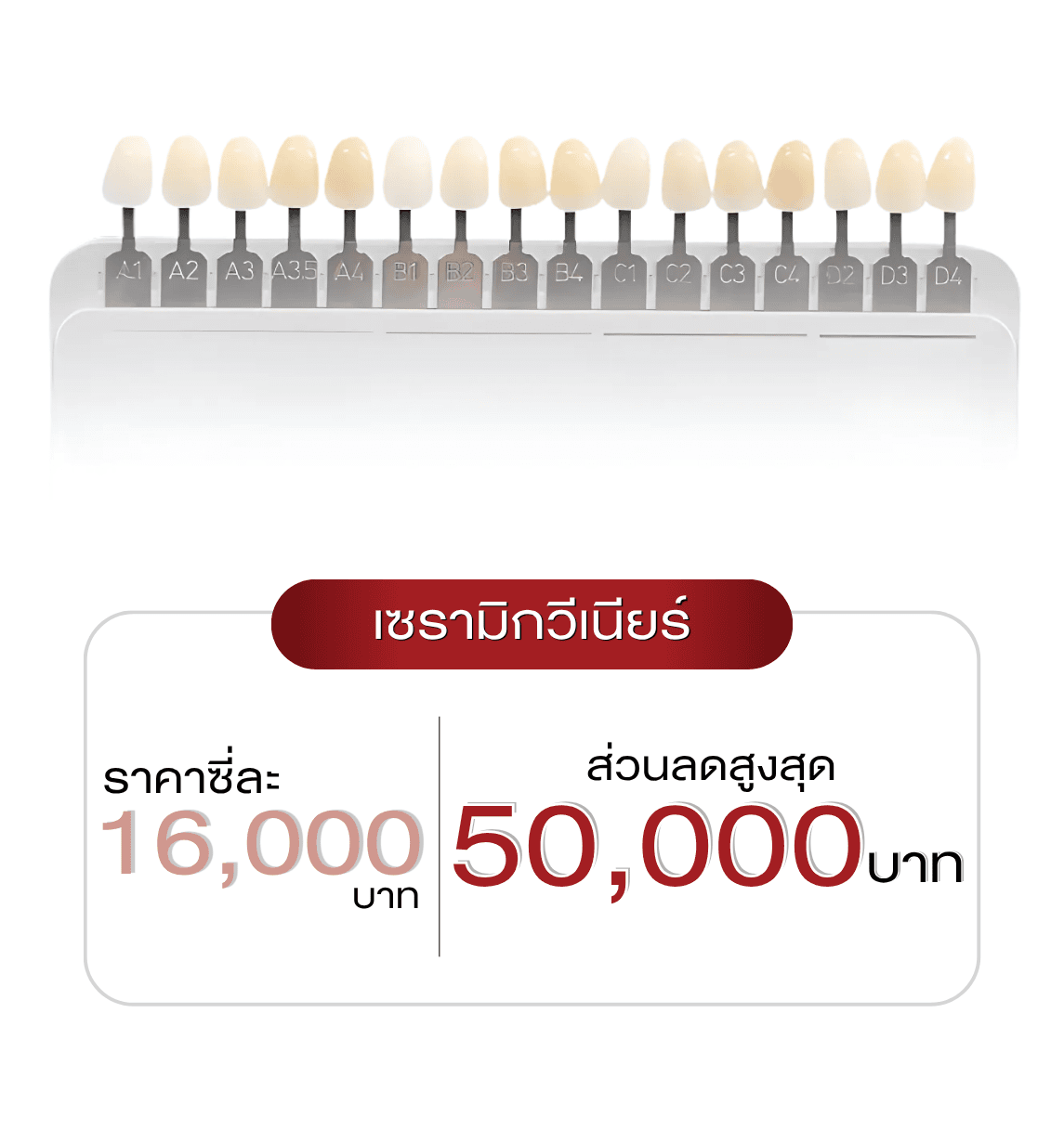 veneer-new-price
