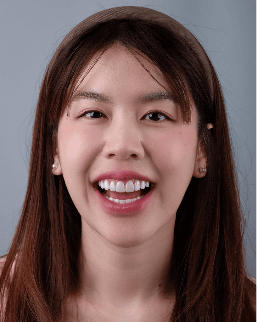 ning-veneer