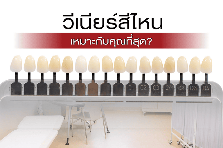 เลือกสีวีเนียร์แบบไหนดี?