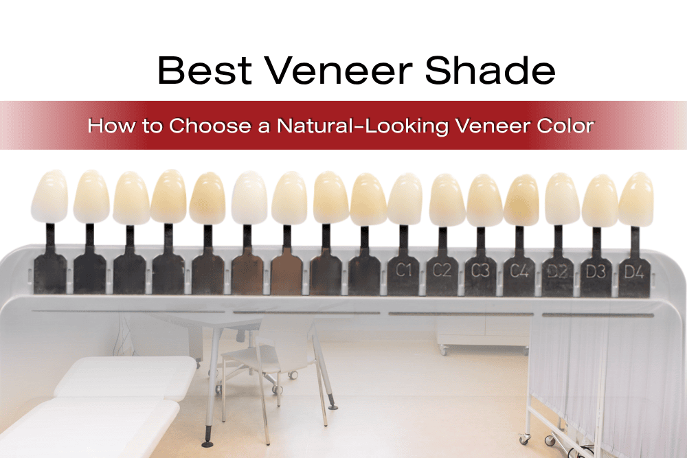 Read more about the article Best Veneer Shade: How to Choose a Natural-Looking Veneer Color 
