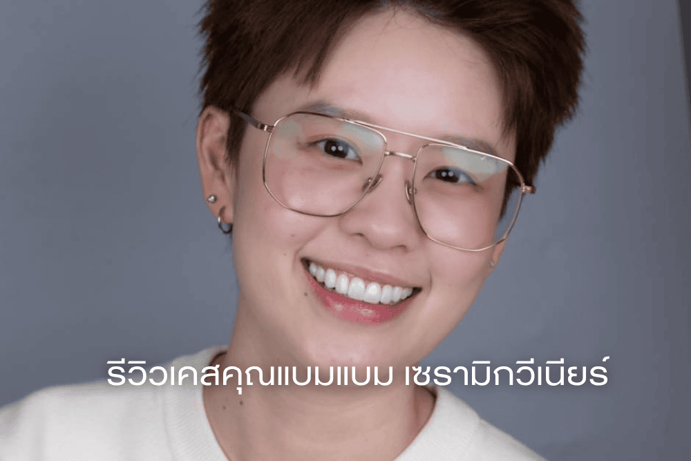 Read more about the article รีวิวเคสคุณแบมแบม เซรามิกวีเนียร์ (Case Review)